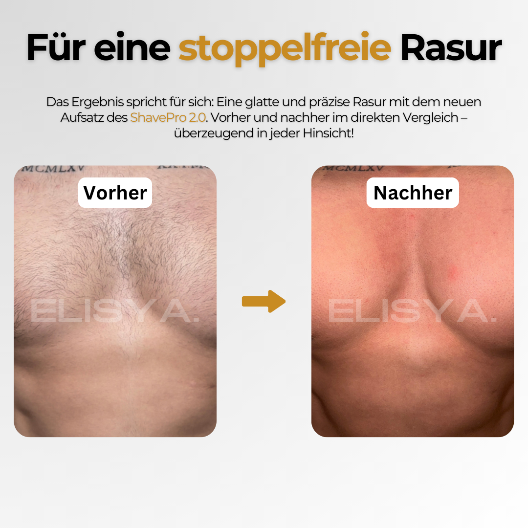 Shave Pro™ 2.0 Ultra - Für die Intim- und Körperpflege